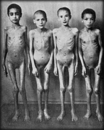 The tragic condition of children in Auschwitz 